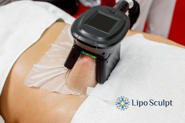 Does Fat Freezing at Home Work? DIY Devices vs Professional Cryolipolysis 1 How is professional cryolipolysis different East Grinstead?