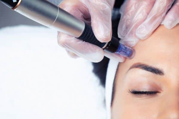 Explaining Total Skin Tightening Treatment and What to Expect 2 What Skin Concerns Can Total Skin Tightening Treatment Help With East Grinstead?
